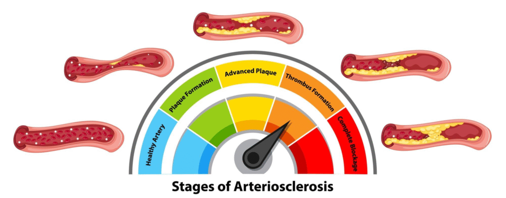 How Creatinine Levels Indicate Kidney Function