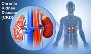 Chronic Kidney Disease