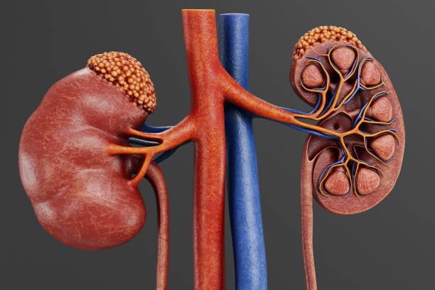 Stage 3 CKD