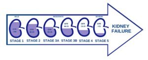 Stages of Kidney Disease