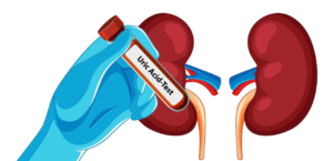 What is Proteinuria? A Warning Sign of Kidney Damage